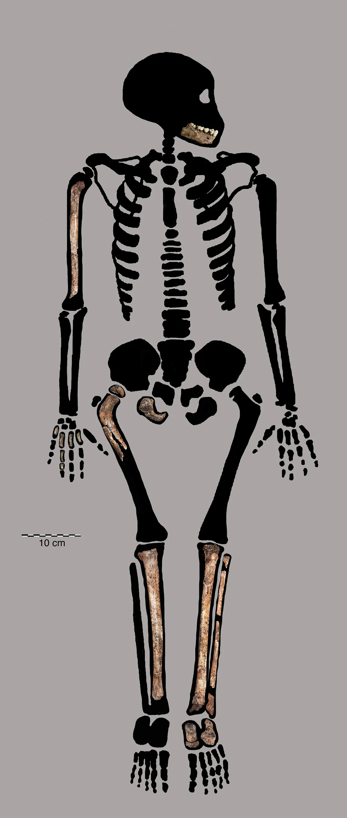 DH7 cranium of Homo naledi, frontal view, showing the small braincase and supraorbital morphology
